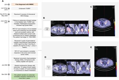 Frontiers Avelumab Maintenance Therapy For Node Positive Muscle